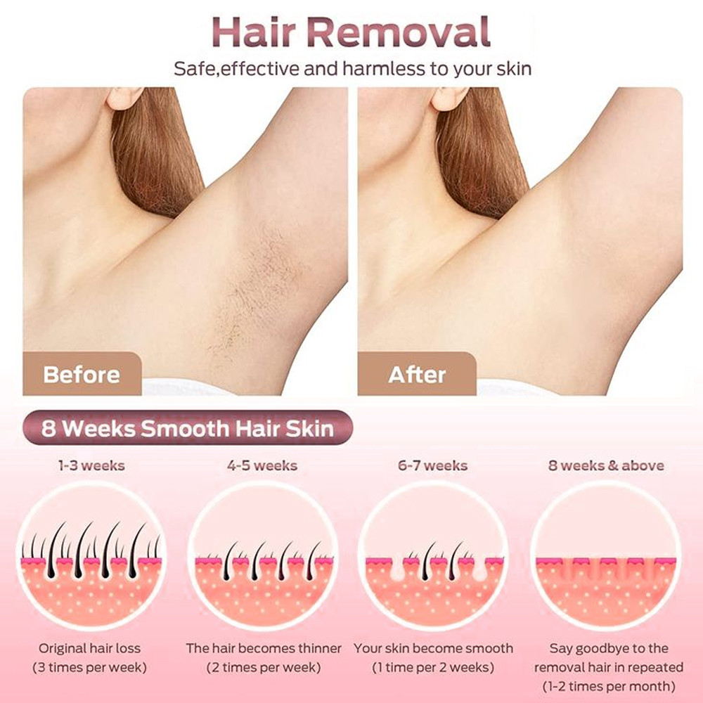 أحدث حالة شركة حول كم تكلف عملية إزالة الشعر بالليزر في الولايات المتحدة