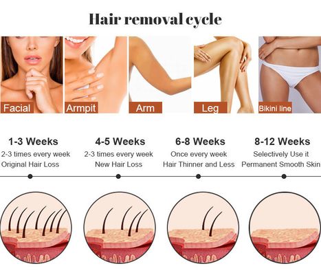 صالون جمال IPL آلة الليزر إزالة الشعر العناية بالبشرة RF إزالة الوشم