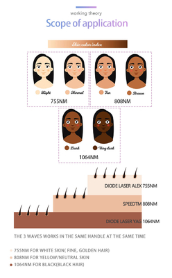 آلة إزالة الشعر بالليزر المهنية