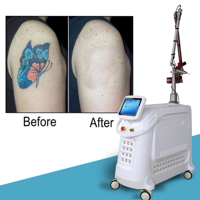 4 أطوال موجة Nd YAG Q Switch Laser Machine إزالة الوشم النمط الثابت