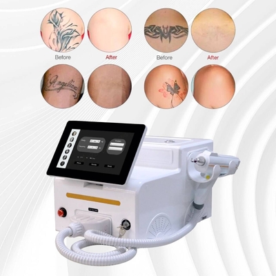 آلة لعلاج الفطريات بالليزر 1064nm 532nm طول الموجة 1320nm