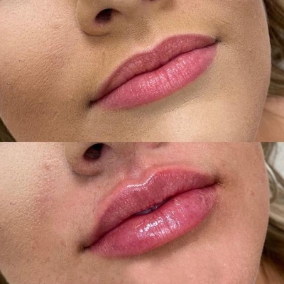4 في 1 آلة تجميل متعددة الوظائف ثلاثي طول الموجة ليزر آلة إزالة الوشم الشعر